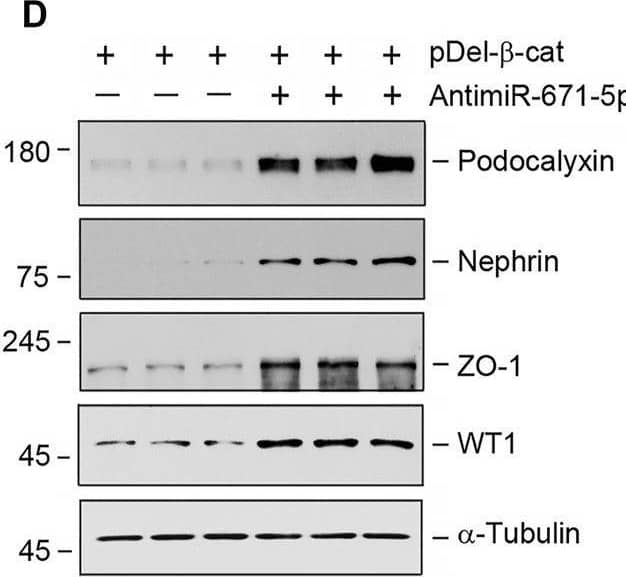 Detection of Podocalyxin by Western Blot