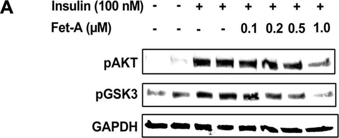 Detection of Fetuin A/AHSG by Western Blot