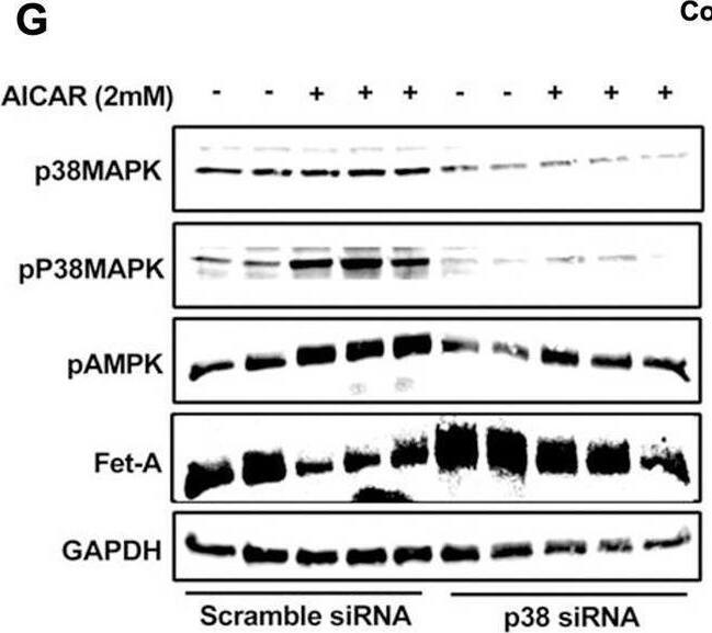 Detection of Fetuin A/AHSG by Western Blot