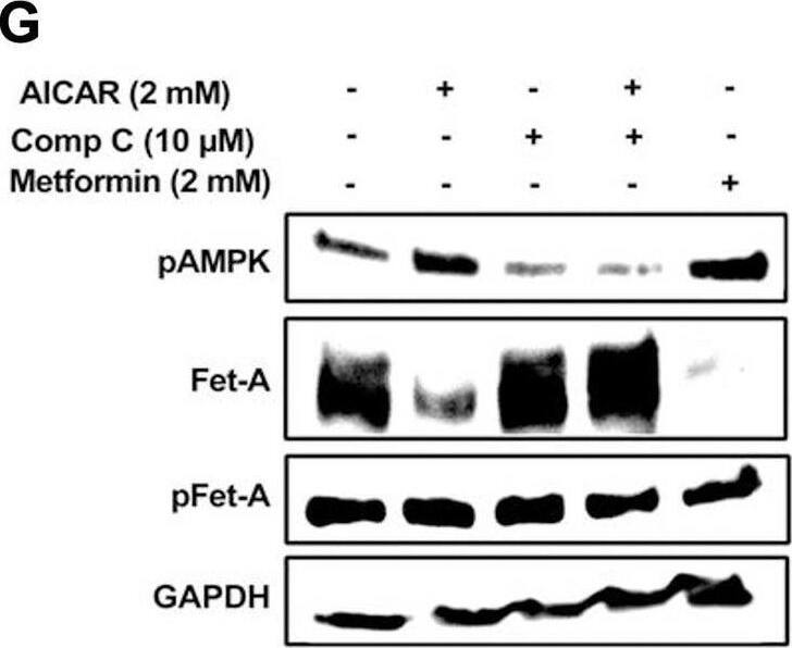 Detection of Fetuin A/AHSG by Western Blot