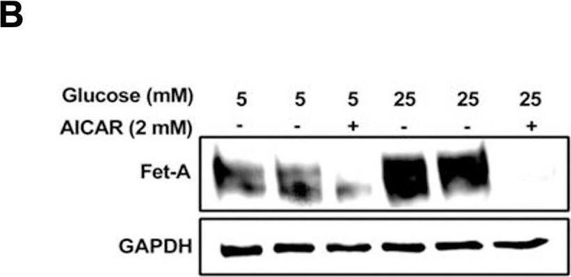 Detection of Fetuin A/AHSG by Western Blot