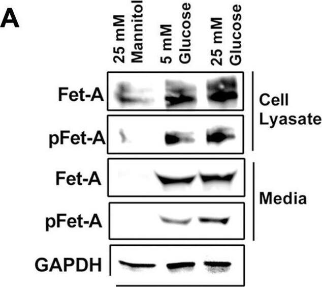 Detection of Fetuin A/AHSG by Western Blot