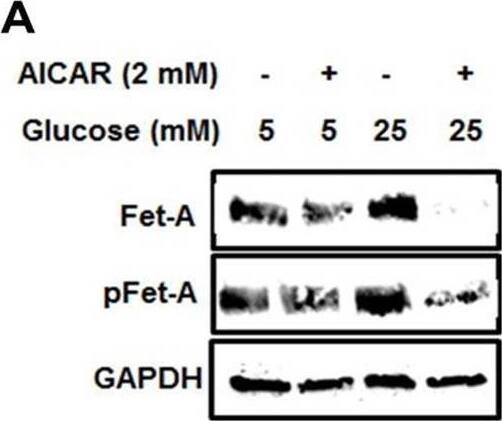 Detection of Fetuin A/AHSG by Western Blot