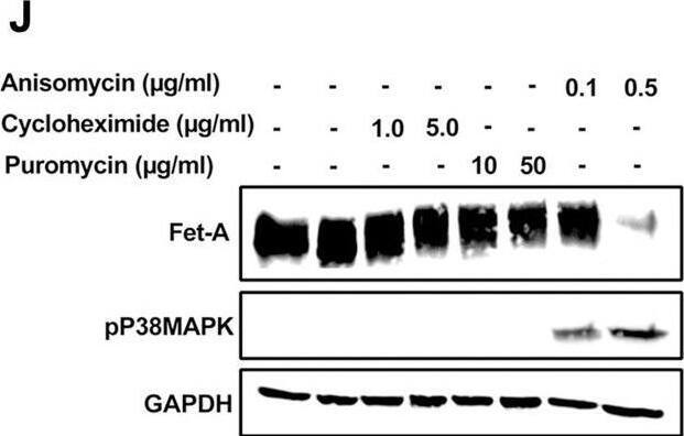 Detection of Fetuin A/AHSG by Western Blot