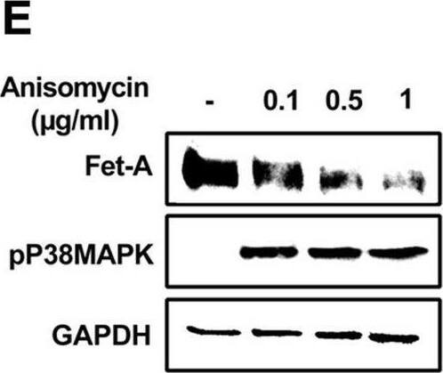 Detection of Fetuin A/AHSG by Western Blot