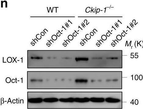 Detection of Mouse LOX-1/OLR1 by Western Blot