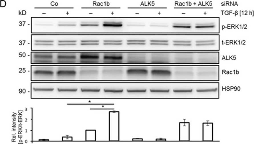 Detection of Human ERK1/ERK2 by Western Blot