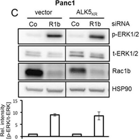 Detection of Human ERK1/ERK2 by Western Blot