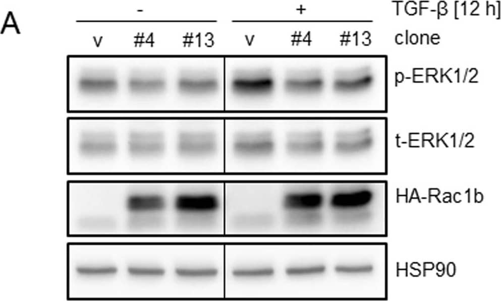 Detection of Human ERK1/ERK2 by Western Blot