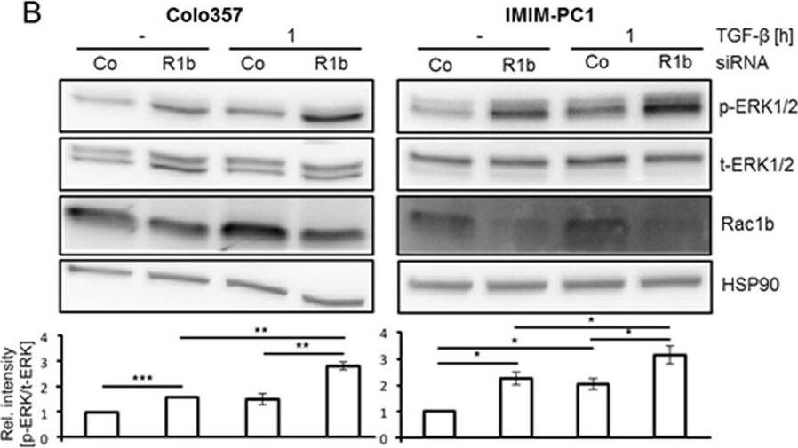 Detection of Human ERK1/ERK2 by Western Blot