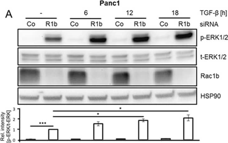 Detection of Human ERK1/ERK2 by Western Blot