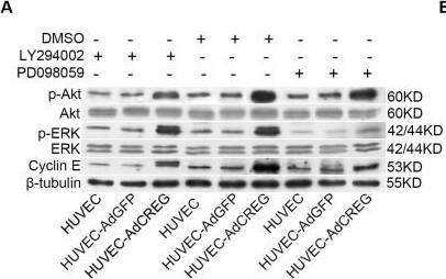 Detection of Human ERK1/ERK2 by Western Blot