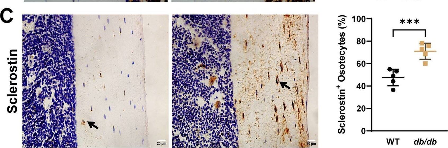 Detection of SOST/Sclerostin by Immunohistochemistry
