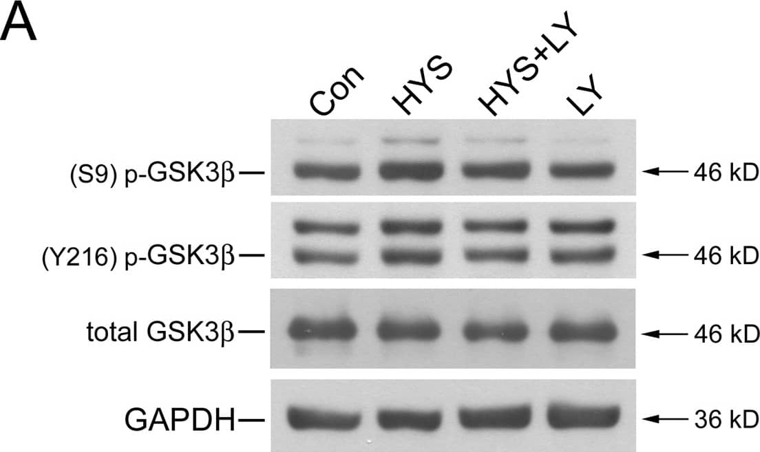 Detection of Rat GSK-3 alpha/beta by Western Blot Detection of Rat GSK-3 alpha/beta by Western Blot