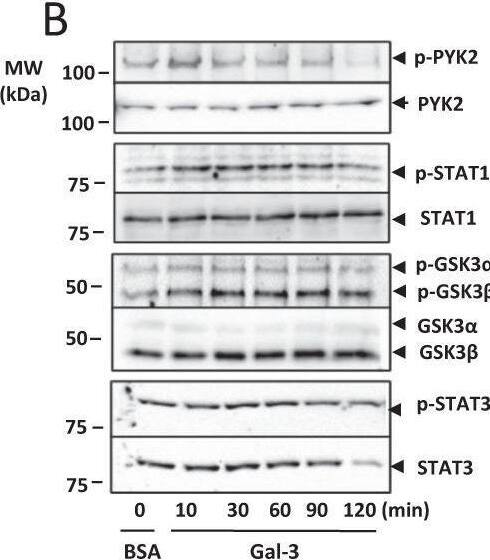 Detection of Phospho-GSK-3 alpha/ beta (S21/S9) by Western Blot