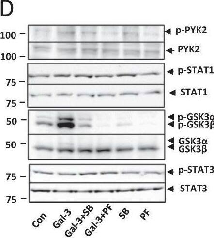 Detection of Phospho-GSK-3 alpha/ beta (S21/S9) by Western Blot