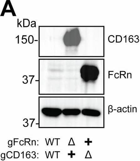 Detection of CD163 by Western Blot
