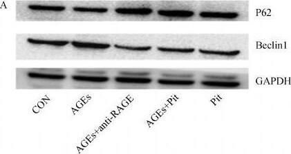 Detection of Rat RAGE by Western Blot