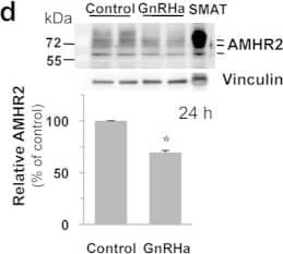 Detection of Mouse MIS RII/AMHR2 by Western Blot