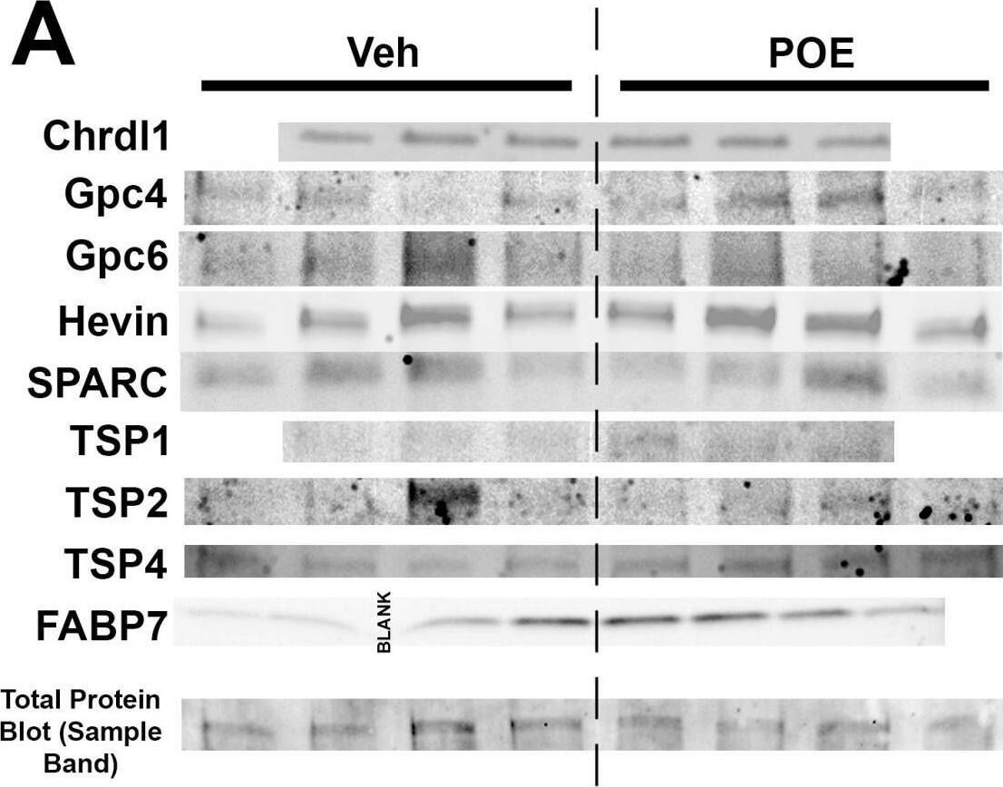 Detection of Thrombospondin-2 by Western Blot