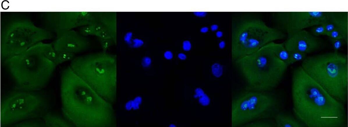 Detection of Human Nucleostemin by Immunocytochemistry/Immunofluorescence