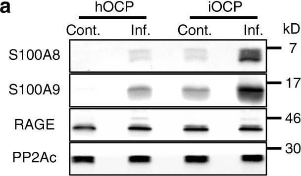 Detection of PP2A Catalytic Subunit by Western Blot
