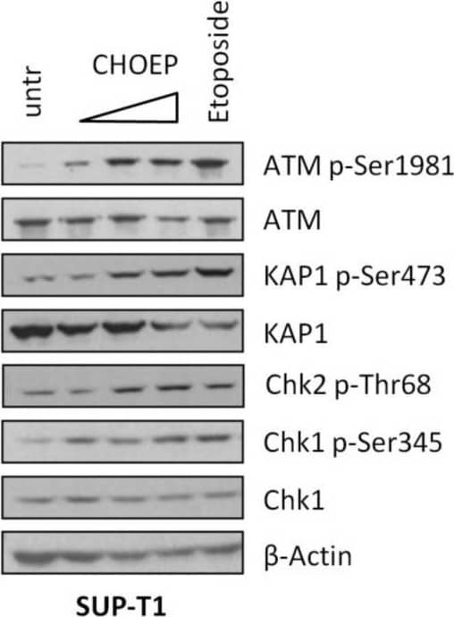 Detection of Human Human/Mouse/Rat Phospho-ATM (S1981) Antibody by Western Blot