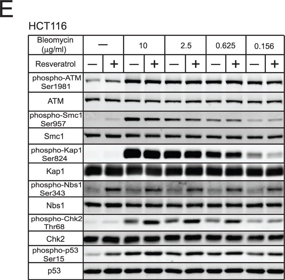 Detection of Human ATM by Western Blot