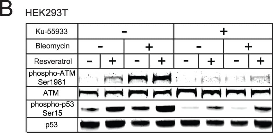 Detection of Human ATM by Western Blot