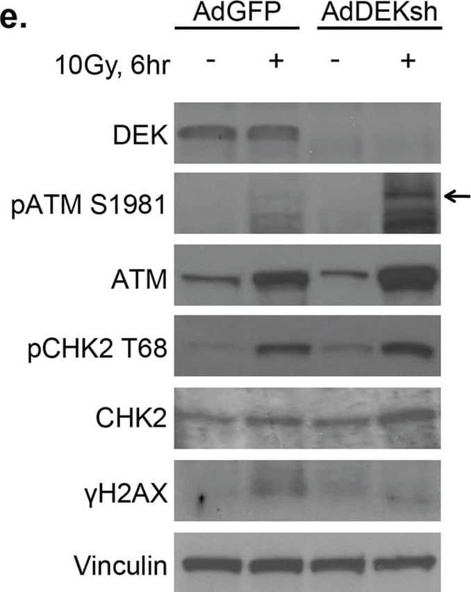 Detection of Human ATM by Western Blot