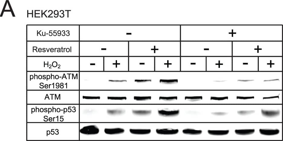 Detection of Human ATM by Western Blot