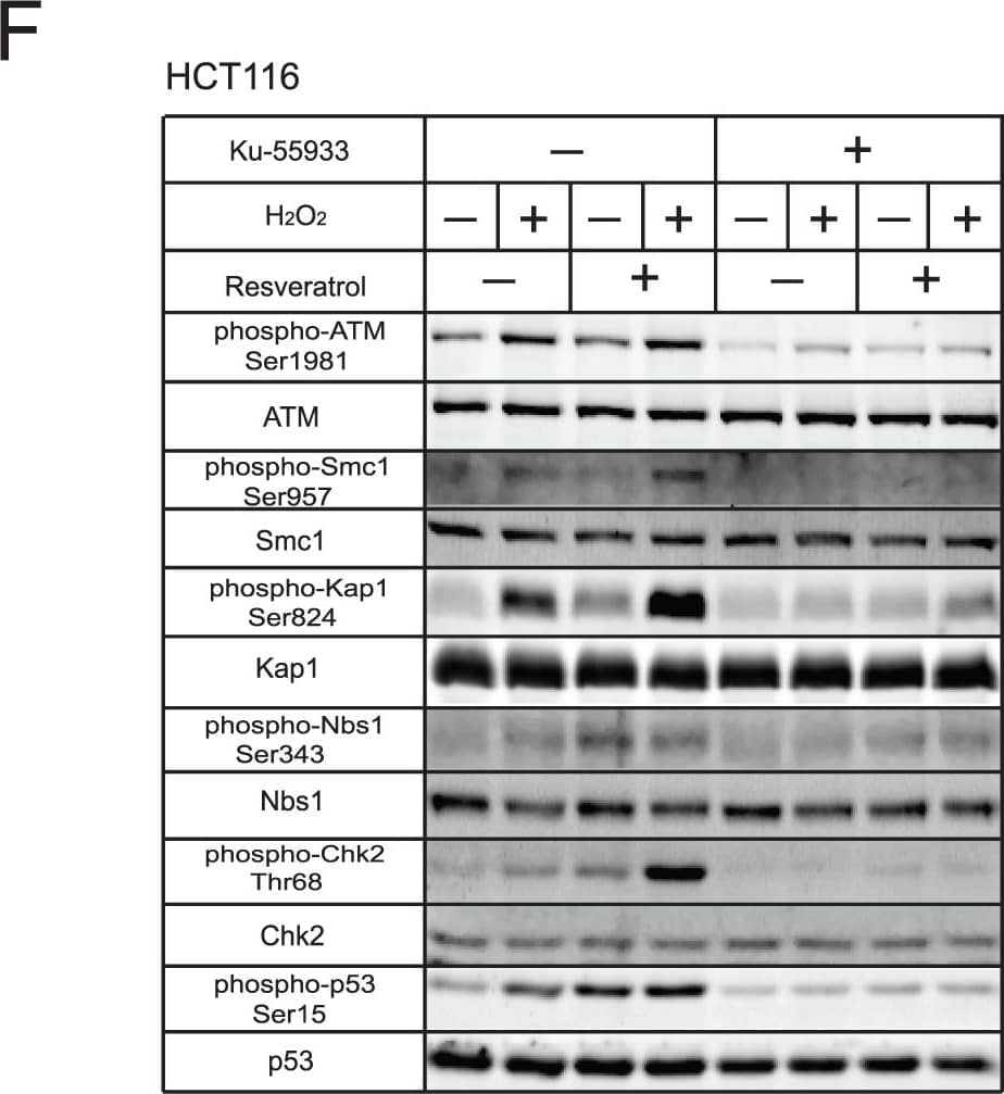 Detection of Human ATM by Western Blot
