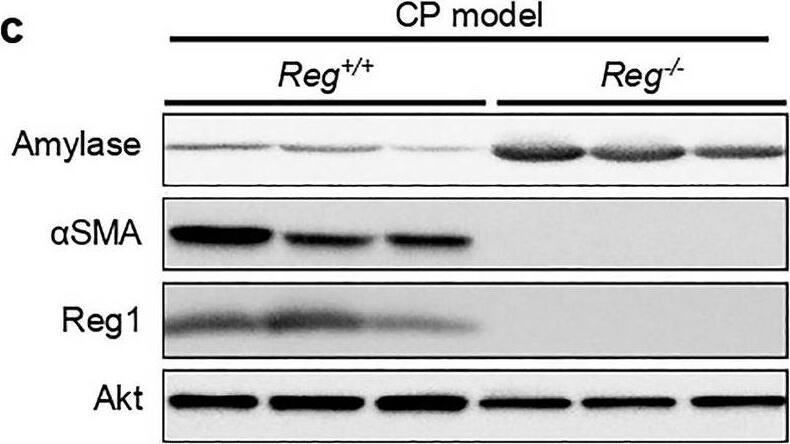 Detection of Mouse Reg1 by Western Blot