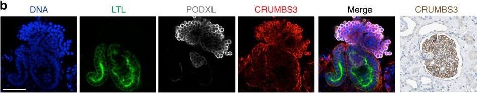 Detection of Human Podocalyxin Like by Immunocytochemistry/Immunofluorescence