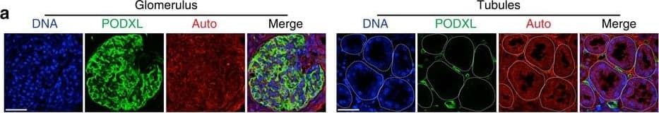 Detection of Human Podocalyxin Like by Immunocytochemistry/Immunofluorescence
