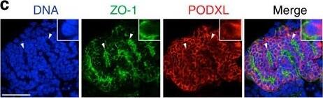Detection of Human Podocalyxin Like by Immunocytochemistry/Immunofluorescence