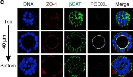 Detection of Human Podocalyxin Like by Immunocytochemistry/Immunofluorescence