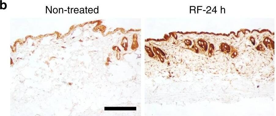 Detection of Mouse HSP70/HSPA1A by Immunohistochemistry