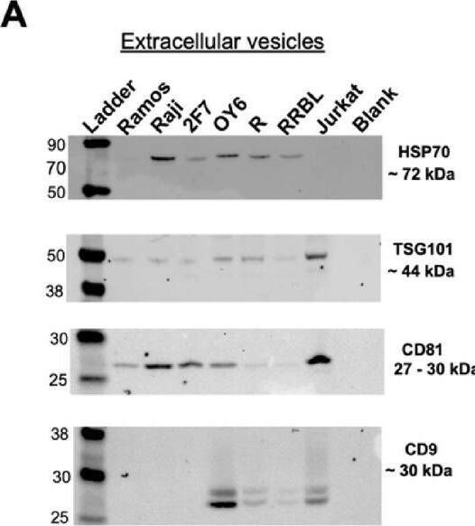 Detection of Human HSP70/HSPA1A by Western Blot