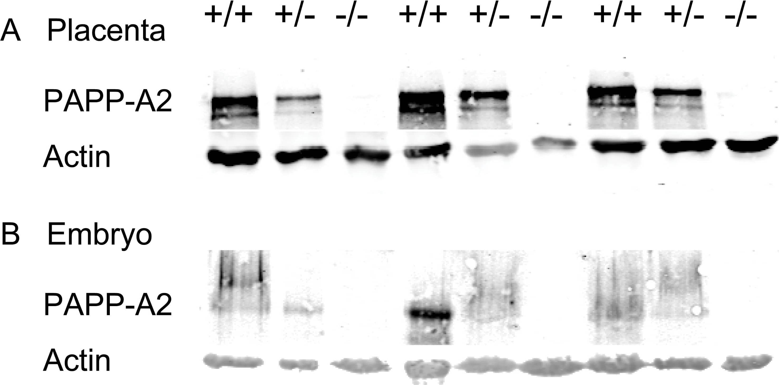 Detection of Pappalysin-2/PAPP-A2 by Western Blot