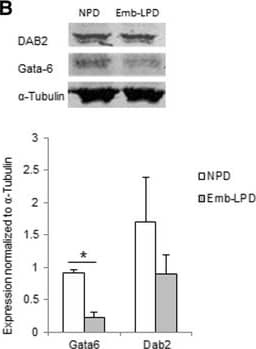 Detection of Human GATA-6 by Western Blot