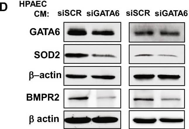 Detection of GATA-6 by Western Blot
