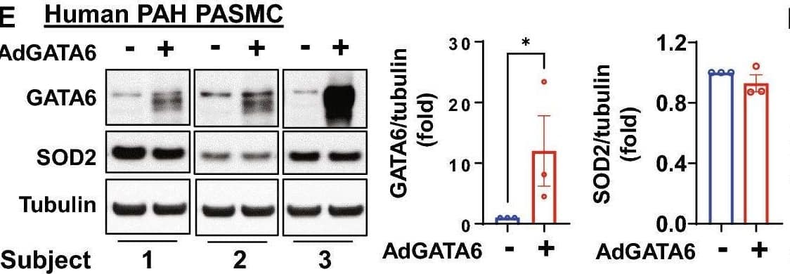 Detection of GATA-6 by Western Blot