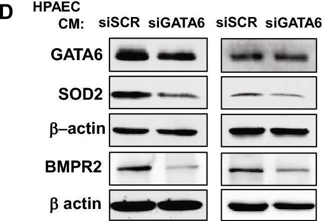 Detection of GATA-6 by Western Blot
