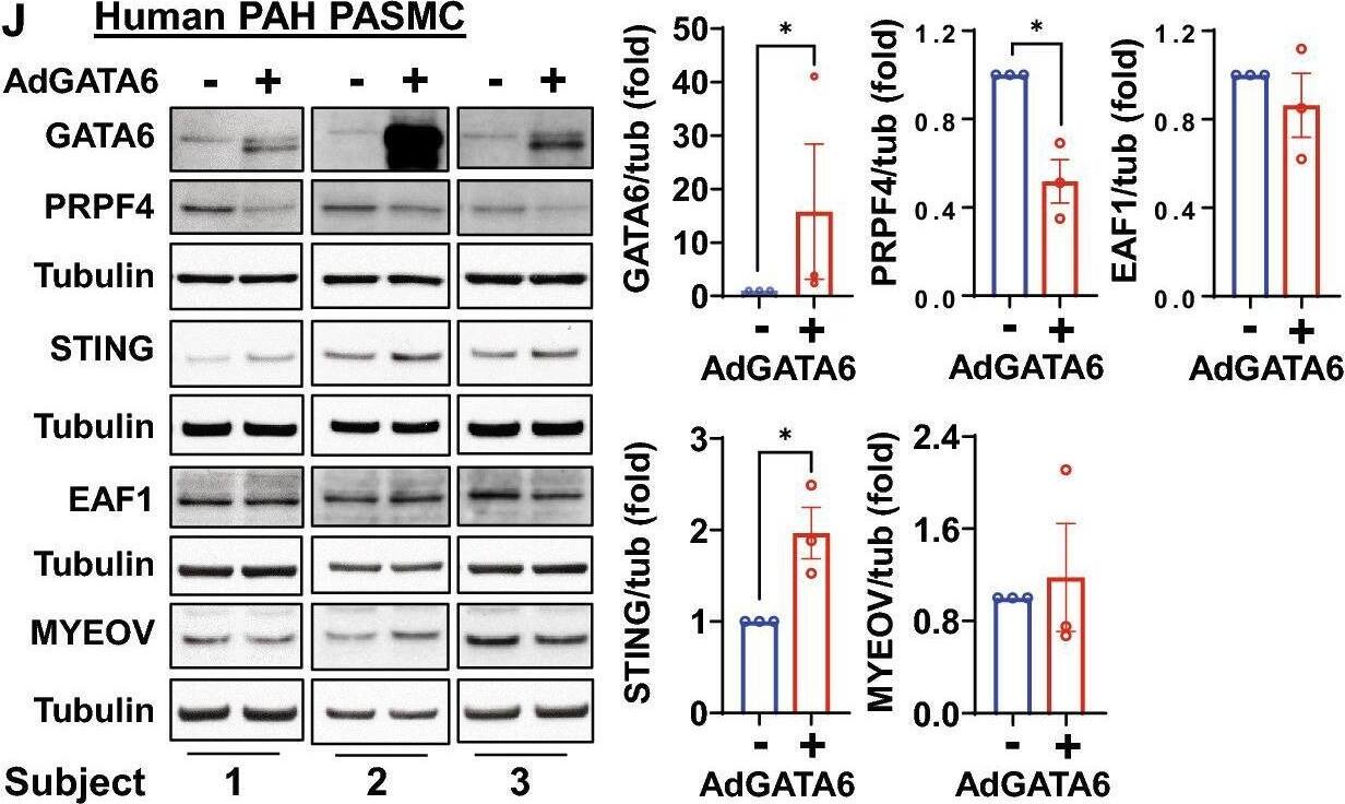 Detection of Human GATA-6 by Western Blot