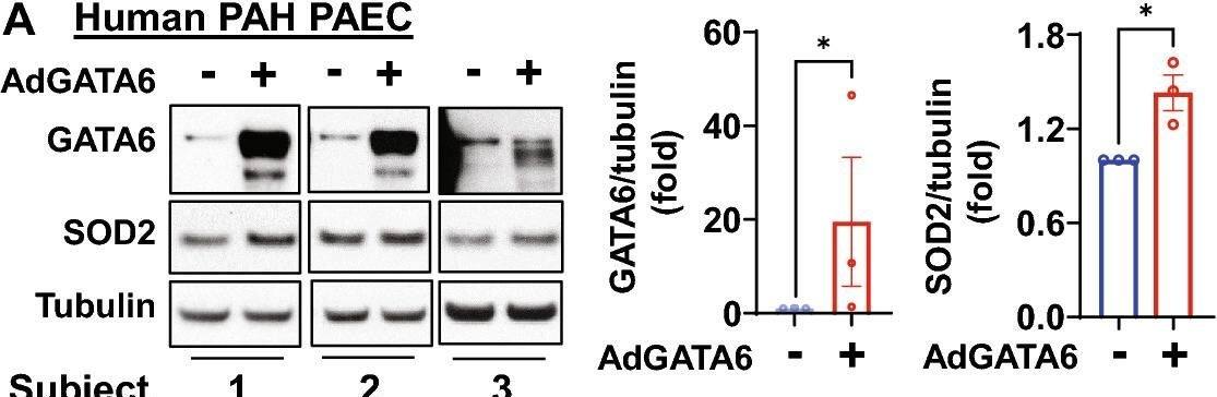 Detection of GATA-6 by Western Blot
