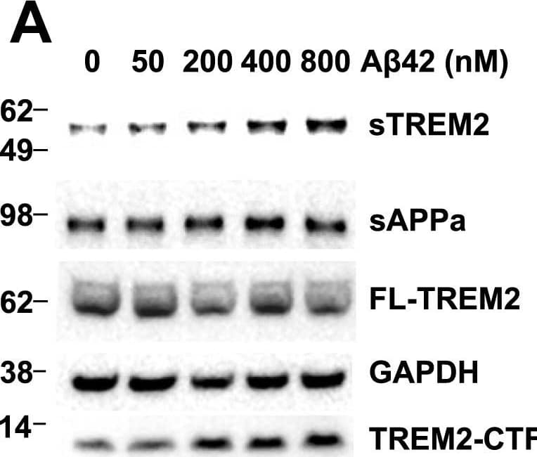 Detection of Mouse Mouse TREM2 Antibody by Western Blot