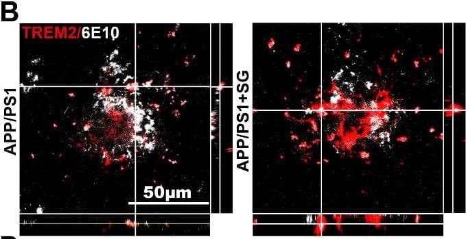 Detection of Mouse TREM2 by Immunocytochemistry/Immunofluorescence