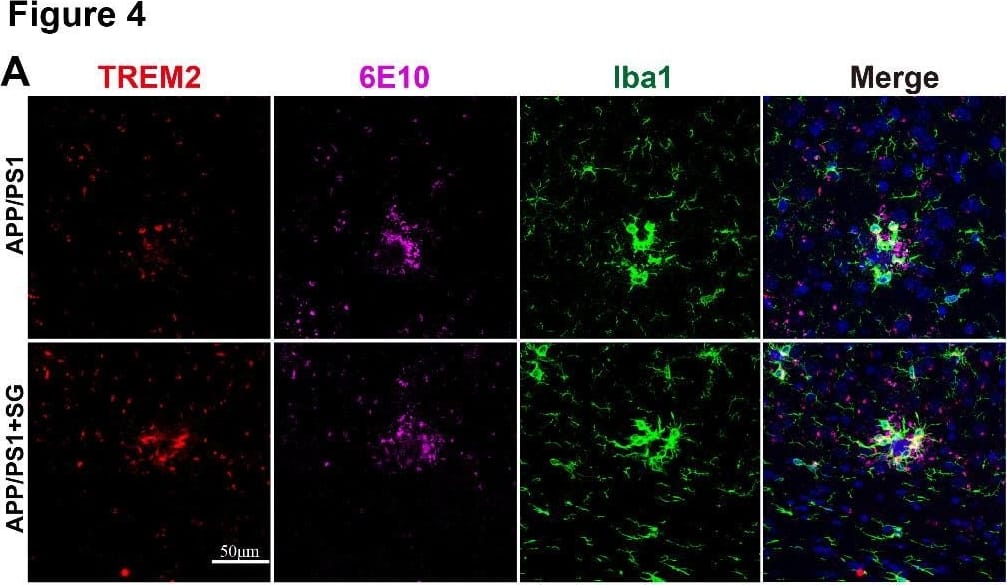 Detection of Mouse TREM2 by Immunocytochemistry/Immunofluorescence