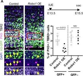 Detection of ROBO1 by Immunohistochemistry